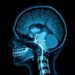 Deep Reinforcement Learning Meets Medical Imaging: Promise and Pitfalls