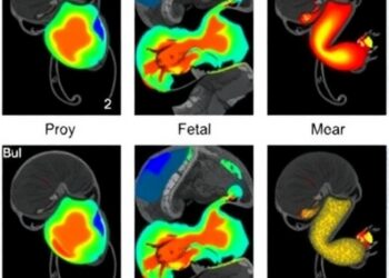 Developmental venous anomalies on fetal magnetic resonance imaging: prevalence and reproducible radiological phenotypes