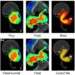 Developmental venous anomalies on fetal magnetic resonance imaging: prevalence and reproducible radiological phenotypes