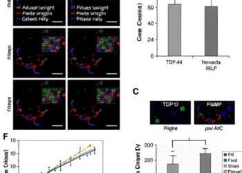 Disrupted TDP-43/RILP pathway impairs cellular cleanup and stress granule balance