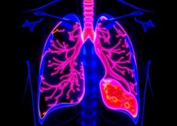 Dual-gain color-NIR chip enables fluorescence-guided lung and breast cancer surgery
