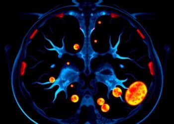 Early Trial Tests Ontorpacept Plus Doxorubicin for Advanced Leiomyosarcoma