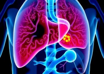 Early US Clinical Results Show Histotripsy Treating Liver Tumors