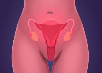 Endometriosis Linked to 46% Higher Type 2 Diabetes Risk in Women