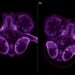 EVERGREEN Study Evaluates Everolimus After Progression in Advanced ER-Positive, HER2-Negative Breast Cancer