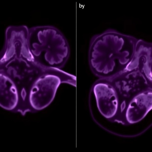 EVERGREEN Study Evaluates Everolimus After Progression in Advanced ER-Positive, HER2-Negative Breast Cancer