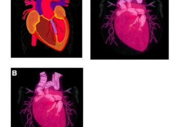 Fabry Disease Linked to Giant Coronary Aneurysms in a Seven-Month-Old Infant