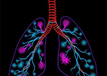 FAK Splicing Variants Reveal New Therapeutic Vulnerability in Small Cell Lung Cancer