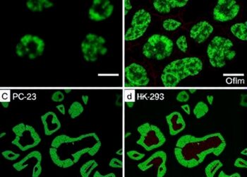 Free versus nano-encapsulated gallic acid compared in PC-3 and HEK-293 cells