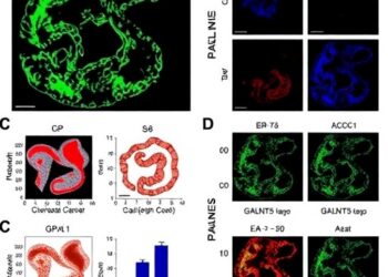 GALNT5 fuels colorectal cancer growth and drug resistance through PI3K/Akt/ABCC1 pathway