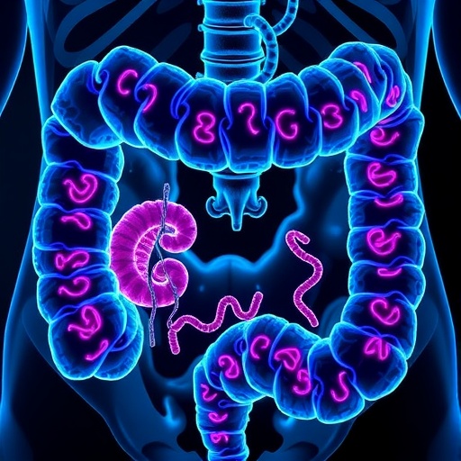 GNG10 Drives Colorectal Cancer Through Non-Canonical Wnt Signaling