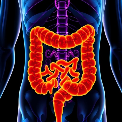 Gut Microbiota Shape Radiotherapy Effectiveness and Toxicity in Colorectal Cancer