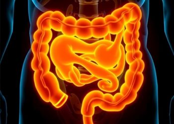 High-dose vitamin D added to standard therapy for metastatic colorectal cancer
