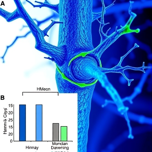 HMGA1 Promotes Bone-Like Transformation of Vascular Muscle Cells in Kidney Disease