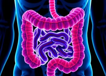 How Aggressive Colon Cancer Tumors Evade the Immune System