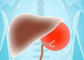How Dyslipidaemia and Fatty Liver Shape Lipid-Lowering Treatment Strategies