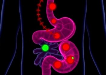 How Macrophages Help Gastric Tumors Resist Immunotherapy