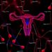 How SHH-Wnt crosstalk, DNA methylation, and miRNAs drive uterine fibroids