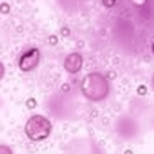 Hyaluronic Acid May Predict Severity of Down Syndrome-Associated Transient Abnormal Myelopoiesis