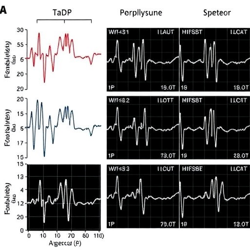 Inducible ventricular arrhythmias predict clinical events in mitral valve prolapse syndrome