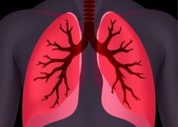 Initial-Dose Tarlatamab-Associated Tumor Lysis Syndrome in Small Cell Lung Cancer