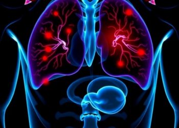 Isoleucine and Valine Fuel Prostate Cancer Progression by Altering Cholesterol Metabolism