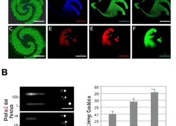 JmjC1 Controls Virulence Genes Linked to Severe Malaria in Plasmodium falciparum