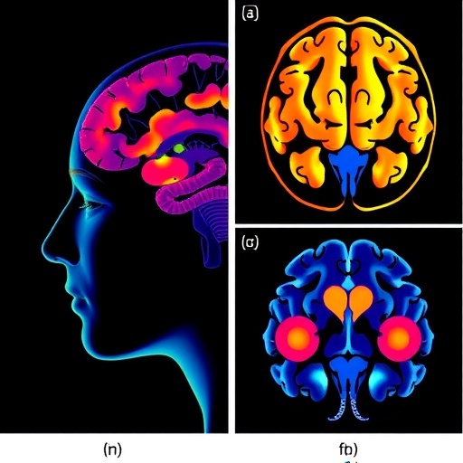 Large fNIRS study finds gender-specific prefrontal activation during verbal fluency in depression