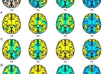 Mapping Targetable Alterations in Glioblastoma Patients