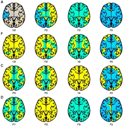 Mapping Targetable Alterations in Glioblastoma Patients