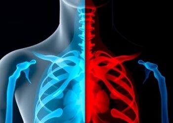 Men Face Higher Tuberculosis Infection Risk Than Women