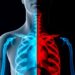 Men Face Higher Tuberculosis Infection Risk Than Women