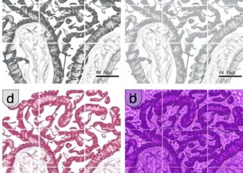 METTL14-Dependent FGF16 m6A Modification Promotes Angiogenesis Following IGFBP5 Deficiency