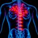 Mitochondria-Targeted Therapy Shows Promise Against Intervertebral Disc Degeneration