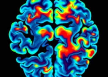 Mixed brain pathologies common in Down syndrome regardless of Alzheimer’s status