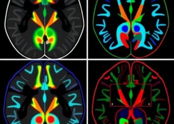 Model-Free Multiparametric SHG Imaging Reveals Collagen Signatures of Breast Cancer