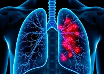 Molecular Residual Disease Testing Guides Care After EGFR-Mutated Lung Cancer Surgery