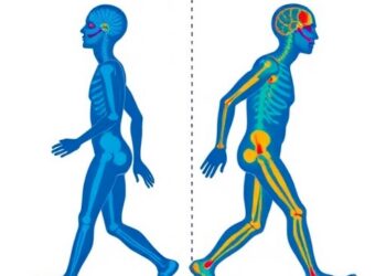 Motor and Non-Motor Symptoms Shape Mobility Capacity and Performance in Parkinson’s Disease