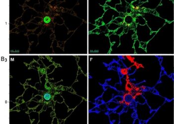 Multiple Myeloma Cell Lines Reveal Clonal Heterogeneity Across One Patient’s Disease Course