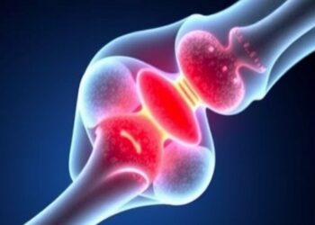 Muscle Plays a Crucial Role Alongside Bone in Fracture Repair