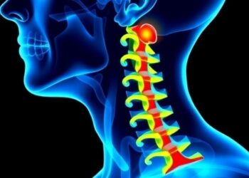Neck Node Yield Influences Immunotherapy Outcomes After Recurrent Head and Neck Cancer