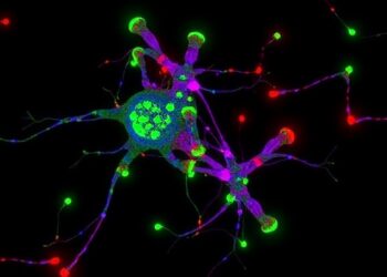 Neuroligin-3–CSPG4 mechanotransduction preserves oligodendrocyte progenitors and promotes glioma growth