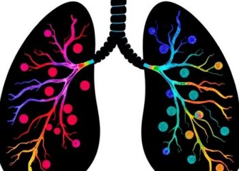 New CAF Population Directs Highly Suppressive Regulatory T Cells in Lung Tumors