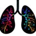 New CAF Population Directs Highly Suppressive Regulatory T Cells in Lung Tumors