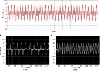 New Multiscale AI Network Improves Automatic Recognition of Complex Wireless Modulation Signals