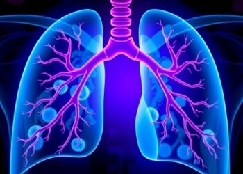 New predictors help stratify bronchiolitis obliterans risk after pediatric stem cell transplant