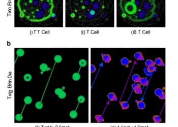 Next-Generation Sequencing Detects Residual Disease in T-Cell Acute Lymphoblastic Leukemia