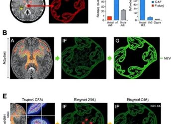 NF-κB-Active Tumors, Matrix CAFs, and Immunosuppression Drive Chemoradiation Resistance in Rectal Cancer