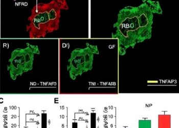NF-κB–TNFAIP3 Pathway Alleviates MASLD by Activating Autophagy in Liver Cells