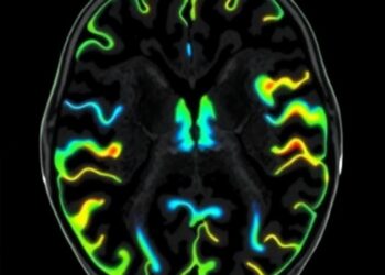Noninvasive Imaging Characterizes Perivascular Spaces in the Subarachnoid Space